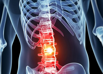 Spinal Cord Injury Lawyer - Las Vegas